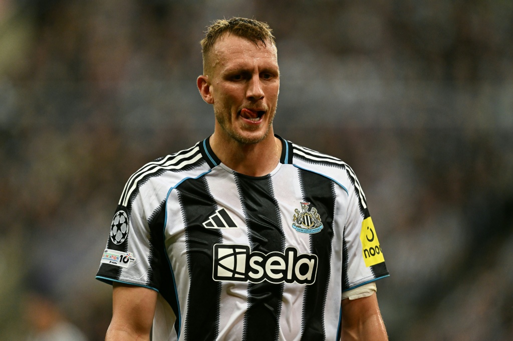 Burn dorong Newcastle tampil kasar dalam duel lawan Bilbao